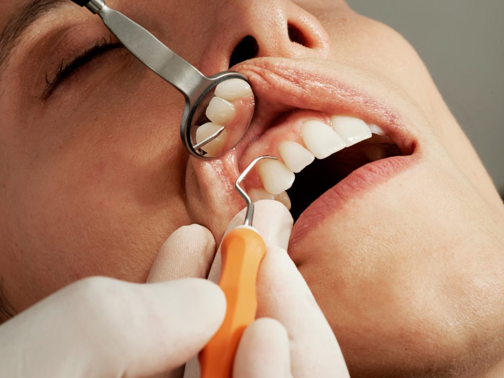 Dental Anatomy 101: Get to Know Your Teeth and Gums