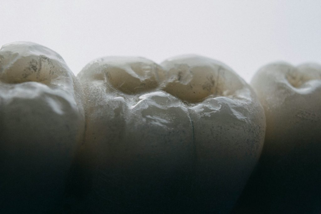 Dental Sealants: What They Are and Why They’re Not Just for Kids