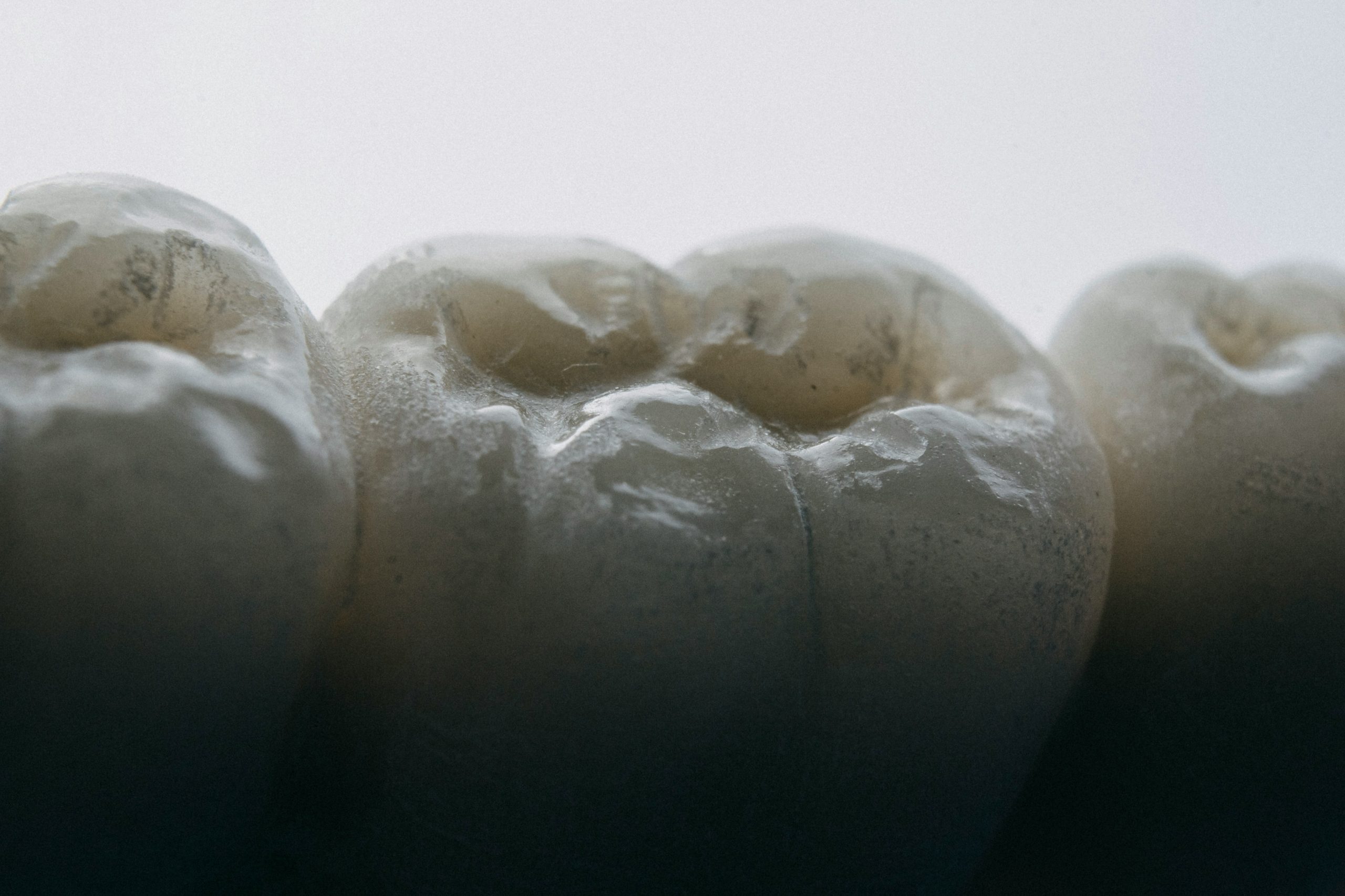 Dental Sealants: What They Are and Why They’re Not Just for Kids