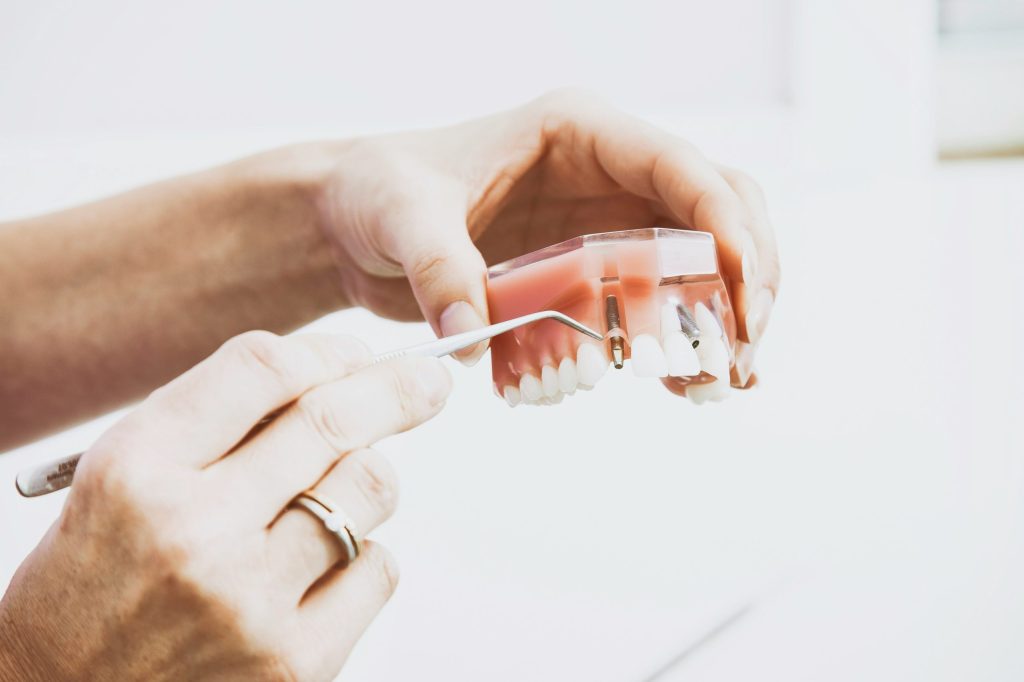 Porcelain vs. Ceramic vs Metal Crowns: Pros and Cons