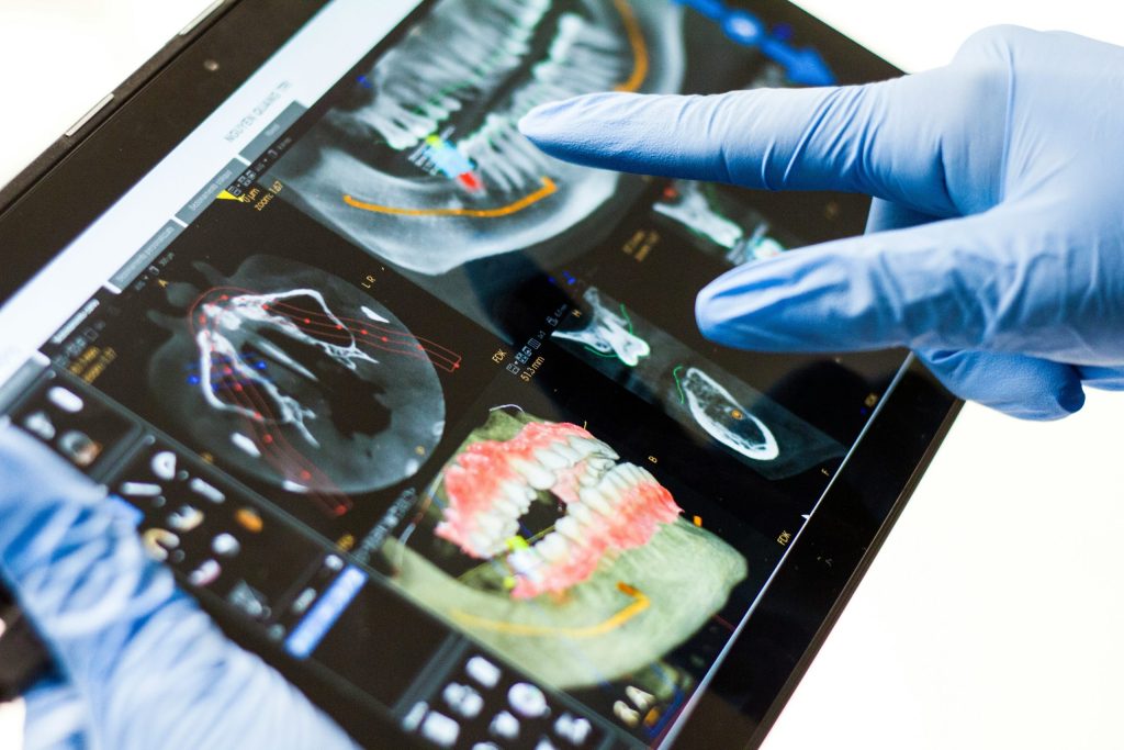 Dental Implants: Prices and FAQs