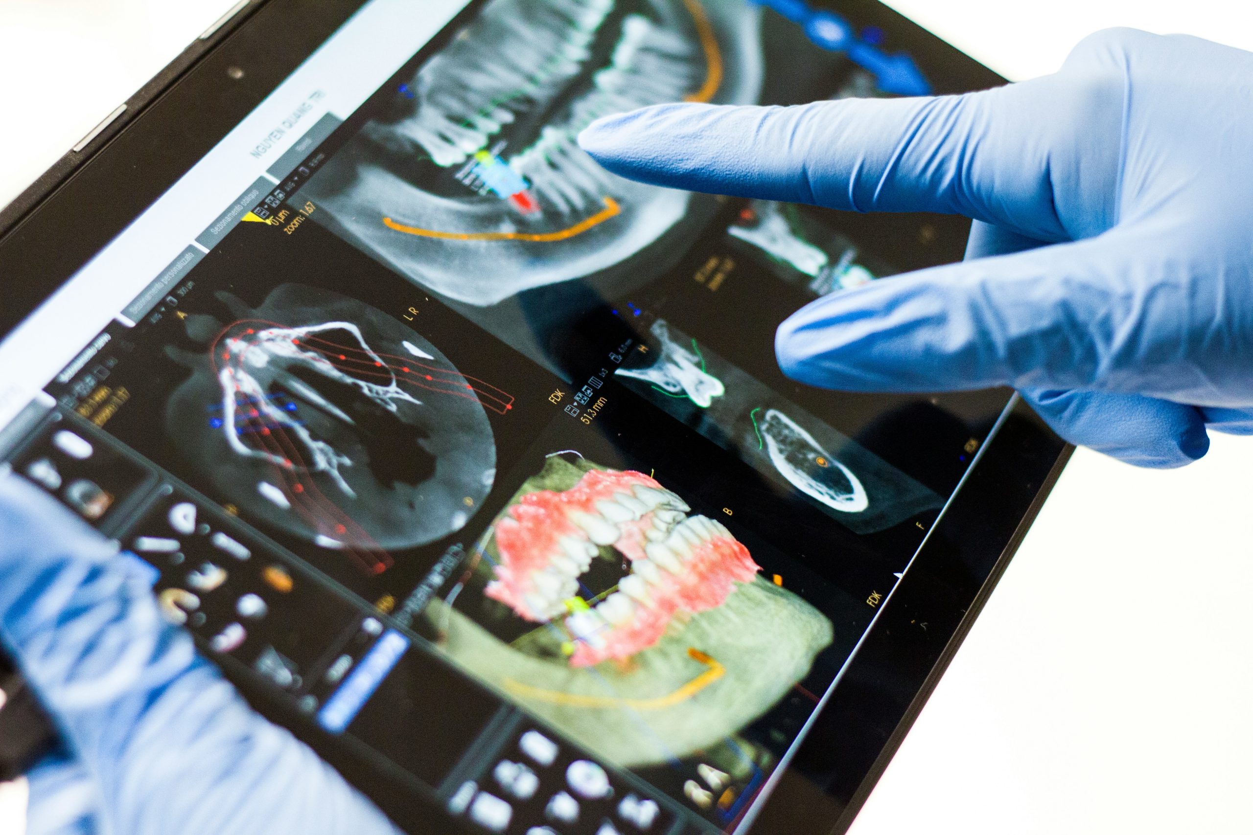 Dental Implants: Prices and FAQs